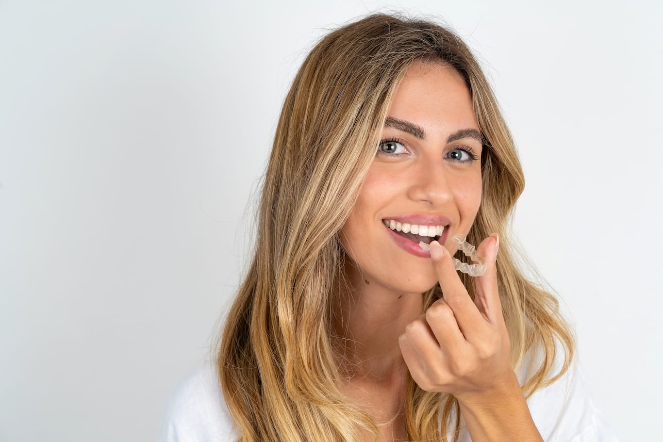 Image Orthodontics