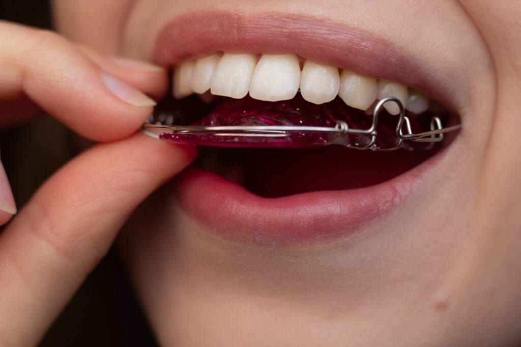 A young woman is putting on her Hawley retainer