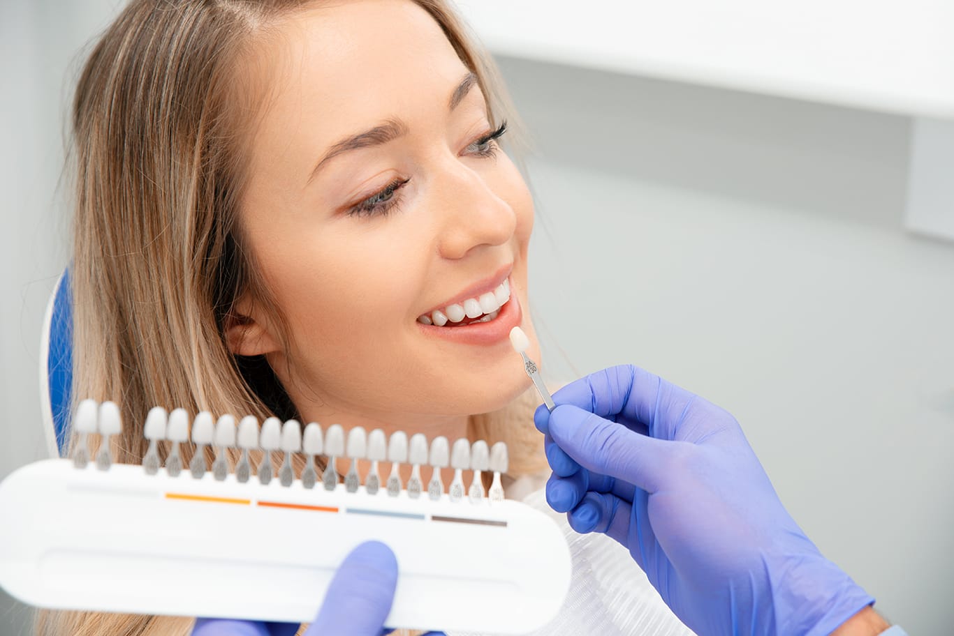 Cosmetic veneers