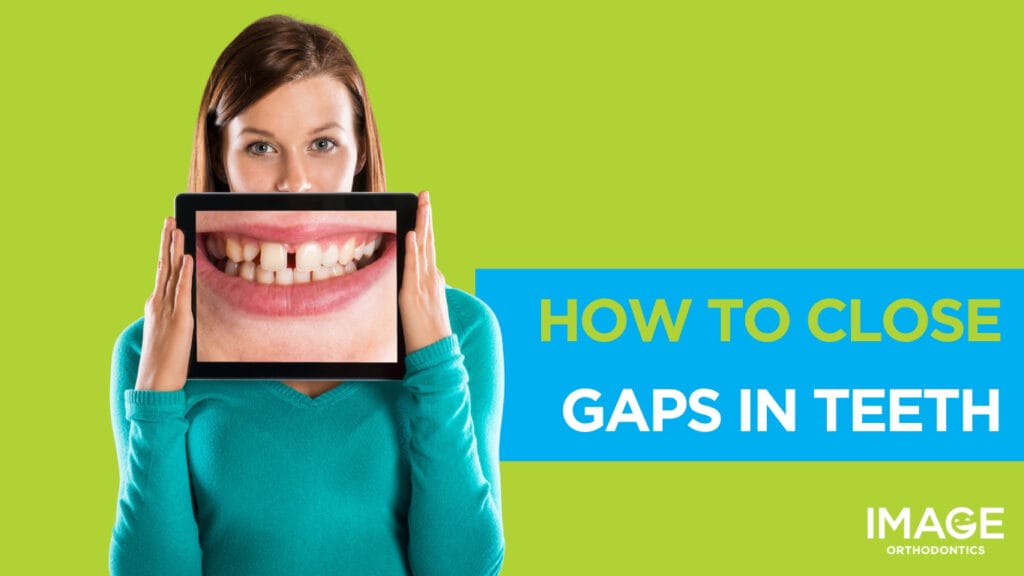 Woman holding a tablet where a mouth with a diastema is shown.