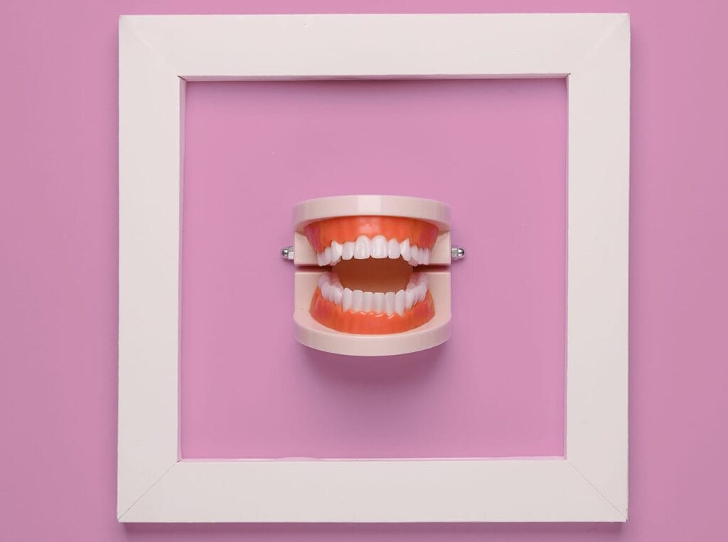 gap in teeth: A dental model with exposed teeth and gums is centered inside a white square frame on a pink background.
