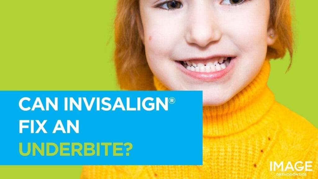 A little girl smiling and showing an underbite