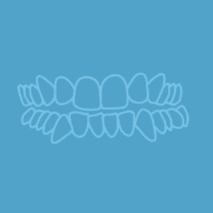 A simple line drawing of an upper and lower set of human teeth on a blue background.