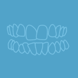 Outline illustration of an upper and lower set of human teeth on a blue background.