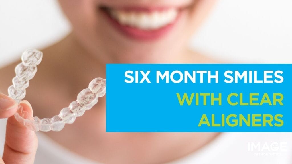 Close-up of a smiling person holding a clear dental aligner