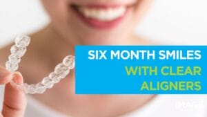 Close-up of a smiling person holding a clear dental aligner
