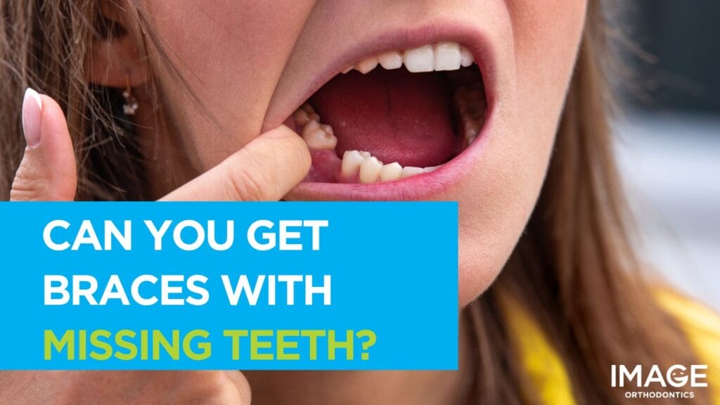 Close-up of a young woman pointing to a missing tooth inside their open mouth