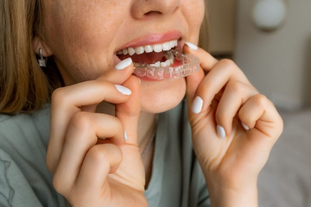 Close-up of a woman placing Invisalign clear aligners on her upper teeth to help improve jaw alignment