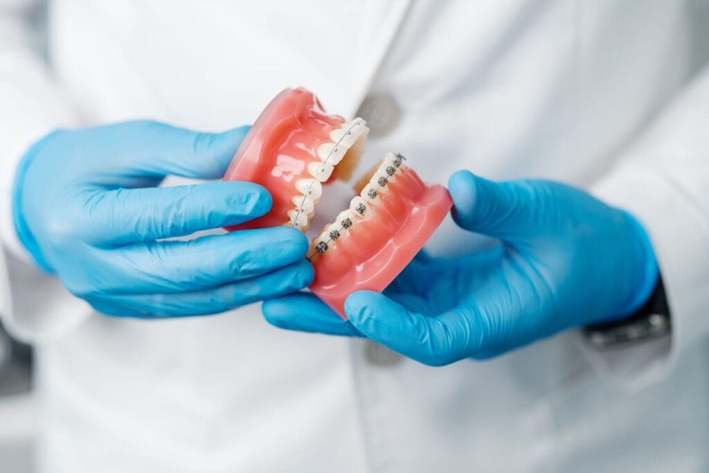Dentist wearing blue gloves holding a dental model displaying ceramic and metal braces to demonstrate teeth and jaw alignment.